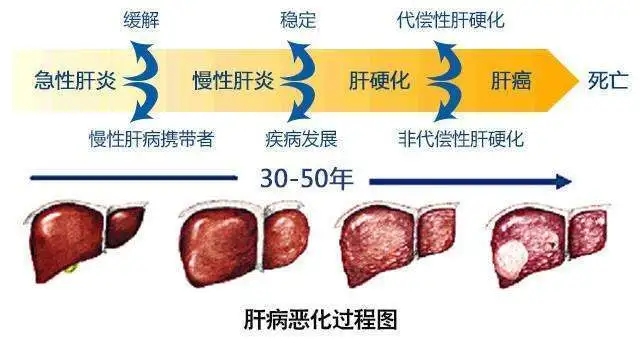 什么是乙型肝炎的常规检查它们有何意义 再造人